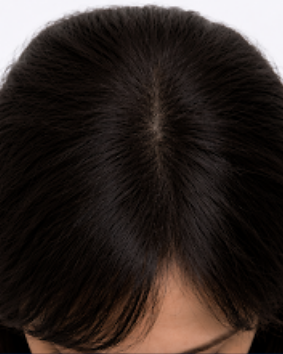 Image link