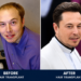 Before and after comparison of a celebrity hair transformation, illustrating improved hairline density and fuller scalp coverage following a modern hair restoration procedure.