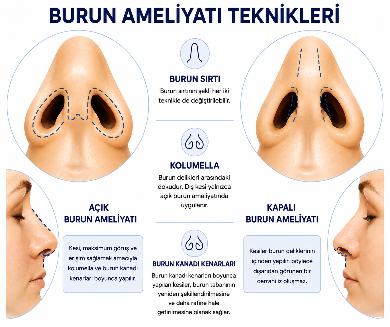 Image link