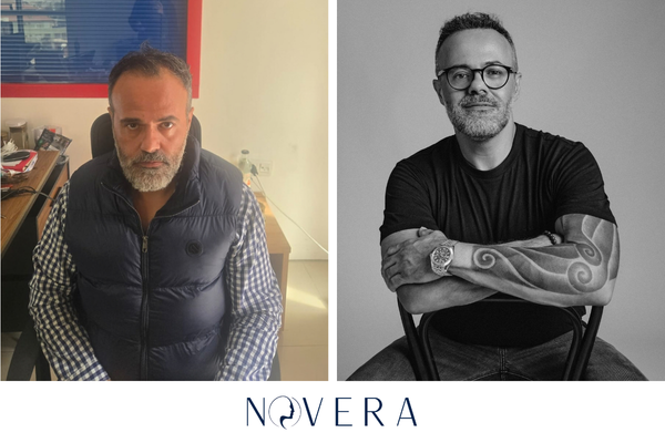 Before-and-after image of a patient who received a hair transplant service.