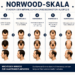Infografik zur Norwood-Skala mit Darstellung der sieben Stadien des männlichen Haarausfalls, von minimalem Zurückweichen des Haaransatzes bis hin zu fortgeschrittenem Haarausfall, jeweils mit Vorder-, Drauf- und Seitenansicht der einzelnen Stadien.